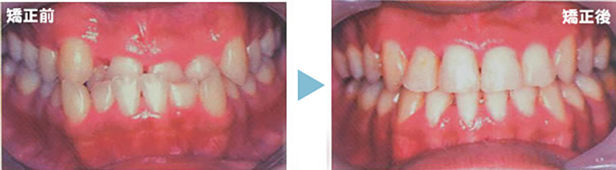 矯正歯科