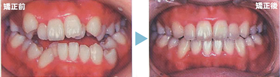 矯正歯科