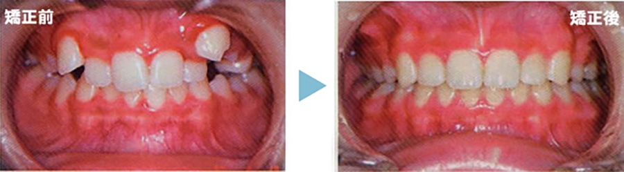 矯正歯科