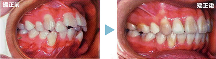 矯正歯科